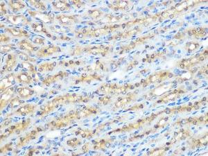 Immunohistochemistry analysis of paraffin-embedded mouse kidney using Anti-PPP1CB Antibody [ARC0981] (A305294) at a dilution of 1:100 (40x lens). Perform microwave antigen retrieval with 10 mM PBS buffer pH 7.2 before commencing with IHC staining protocol