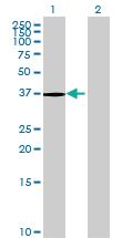 Anti-PTPN7 Mouse Polyclonal Antibody