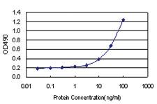 Anti-SNAI1 Polyclonal Antibody Pair