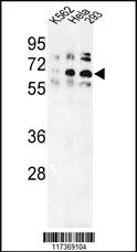 Anti-TRIM33 Rabbit Polyclonal Antibody