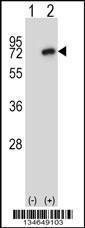 Anti-NEK8 Rabbit Polyclonal Antibody (AP (Alkaline Phosphatase))