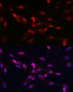 Immunofluorescence analysis of C6 cells using Anti-YAP1 Antibody (A93149) at a dilution of 1:100 (40X lens). DAPI was used to stain the cell nuclei (blue)