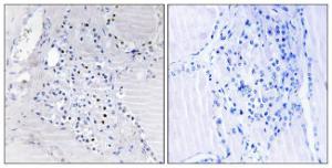 Anti-C9orf89 Rabbit Polyclonal Antibody