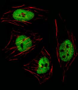 Anti-GTF2I Rabbit Polyclonal Antibody (Biotin)