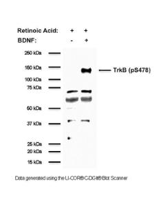 Western blot of TrkB (pS478) in mouse NSC34 cell lysates (20 ?g/lane). TrkB receptor expression was induced by treating NSC34 cells with retinoic acid. TrkB receptor phosphorylation was triggered by adding BDNF protein to the culture medium, while control cells were left untreated.