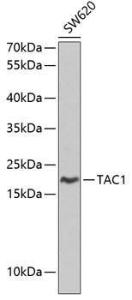 Western blot analysis of extracts of SW620 cells, using Anti-Substance P Antibody (A8953) at 1:1,000 dilution. The secondary antibody was Goat Anti-Rabbit IgG H&L Antibody (HRP) at 1:10,000 dilution.