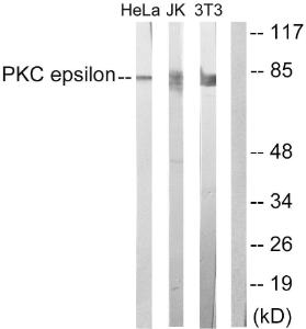 Western blot analysis of lysates from HeLa, Jurkat, and 3T3 cells, treated with PMA 125ng/ml 30' using Anti-PKC epsilon Antibody. The right hand lane represents a negative control, where the antibody is blocked by the immunising peptide