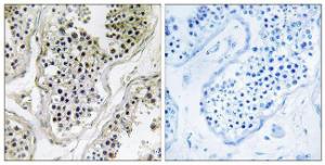 Immunohistochemical analysis of paraffin-embedded human testis tissue using Anti-ATXN7L1 Antibody. The right hand panel represents a negative control, where the antibody was pre-incubated with the immunising peptide