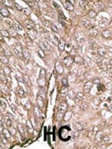 Anti-MAP1ALC3 Rabbit Polyclonal Antibody