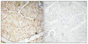 Immunohistochemical analysis of paraffin-embedded human skeletal muscle using Anti-VEGF-A Antibody 1:100 (4°C overnight). The right hand panel represents a negative control, where the antibody was pre-incubated with the immunising peptide