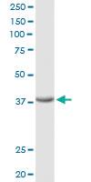 Anti-FRZB Rabbit Polyclonal Antibody