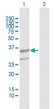 Anti-ABHD11 Mouse Polyclonal Antibody