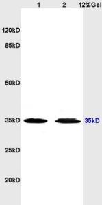 Anti-A3AR Rabbit Polyclonal Antibody