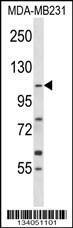 Anti-COPB1 Rabbit Polyclonal Antibody (FITC (Fluorescein Isothiocyanate))