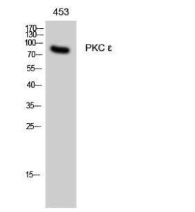 Western blot analysis of 453 cells using Anti-PKC epsilon Antibody