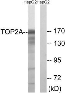 Antibody anti-TOP2A A100734-100 100 µg