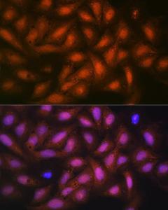 Immunofluorescence analysis of U-2 OS cells using Anti-PPP1CB Antibody [ARC0981] (A305294) at a dilution of 1:100 (40x lens). DAPI was used to stain the cell nuclei (blue)