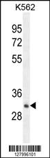 Anti-OR52A1 Rabbit Polyclonal Antibody