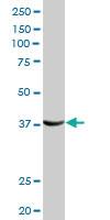 Anti-FRZB Rabbit Polyclonal Antibody