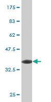 Anti-SNAI1 Mouse Monoclonal Antibody [clone: 2G11]