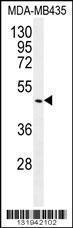 Anti-GDF5 Rabbit Polyclonal Antibody (APC (Allophycocyanin))