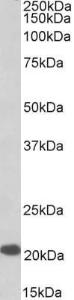 Anti-Dnajc5 Antibody (A85084) (0.1 µg/ml) staining of Human Cerebellum lysate (35 µg protein in RIPA buffer). Primary incubation was 1 hour. Detected by chemiluminescence