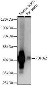 Western blot analysis of extracts of various cell lines, using Anti-Pdha2 Antibody (A93155) at 1:1,000 dilution. The secondary antibody was Goat Anti-Rabbit IgG H&L Antibody (HRP) at 1:10,000 dilution.