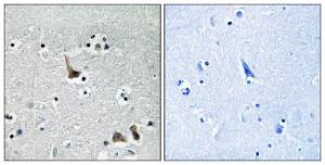 Immunohistochemical analysis of paraffin-embedded human brain tissue using Anti-ATP6V1H Antibody. The right hand panel represents a negative control, where the antibody was pre-incubated with the immunising peptide