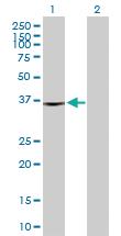 Anti-FRZB Rabbit Polyclonal Antibody