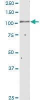 Anti-GANAB Rabbit Polyclonal Antibody