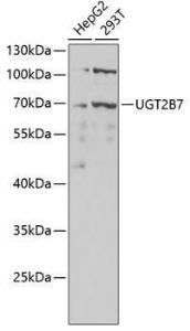 Anti-UGT2B7 Rabbit Polyclonal Antibody