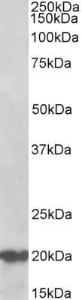 Anti-Dnajc5 Antibody (A85085) (0.5 µg/ml) staining of Human Cerebellum lysate (35 µg protein in RIPA buffer). Primary incubation was 1 hour. Detected by chemiluminescence