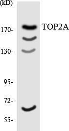 Anti-Topoisomerase II alpha+Topoisomerase II beta Rabbit Polyclonal Antibody