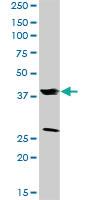 Anti-FRZB Rabbit Polyclonal Antibody