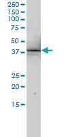 Anti-SNUPN Mouse Monoclonal Antibody [clone: 2B2-1B4]