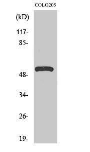 Western blot analysis of various cells using Anti-ATP6V1H Antibody