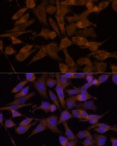 Anti-UGT2B7 Rabbit Polyclonal Antibody