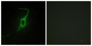 Immunofluorescence analysis of NIH/3T3 cells using Anti-CDH20 Antibody. The right hand panel represents a negative control, where the antibody was pre-incubated with the immunising peptide