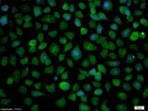 Anti-RASSF1 Rabbit Polyclonal Antibody