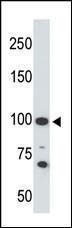 Anti-ACE2 Rabbit Polyclonal Antibody (HRP (Horseradish Peroxidase))