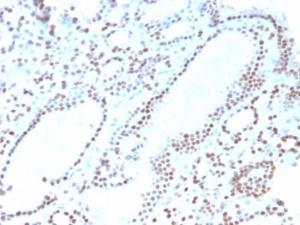 Immunohistochemical analysis of formalin-fixed, paraffin-embedded human thyroid using Anti-PAX8 Antibody [ZR-1]