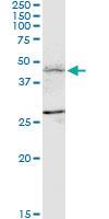 Anti-FBXL7 Mouse Monoclonal Antibody [clone: 2G10]