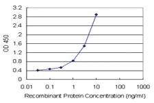 Anti-CETN1 Polyclonal Antibody Pair