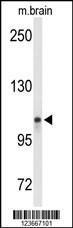 Anti-LONP2 Rabbit Polyclonal Antibody (HRP (Horseradish Peroxidase))