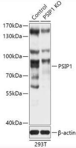 Western blot analysis of extracts from normal (control) and PSIP1 knockout (KO) 293T cells, using Anti-PSIP1 / LEDGF Antibody (A93163) at 1:1,000 dilution. The secondary antibody was Goat Anti-Rabbit IgG H&L Antibody (HRP) at 1:10,000 dilution.