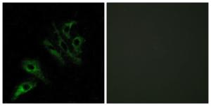 Immunofluorescence analysis of HeLa cells using Anti-TNFL4 Antibody The right hand panel represents a negative control, where the antibody was pre-incubated with the immunising peptide