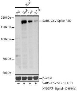 Western blot analysis of extracts of various cell lines, using Anti-SARS spike glycoprotein RBD Antibody (A305297) at 1:1000 dilution