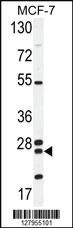 Anti-NUDT8 Rabbit Polyclonal Antibody