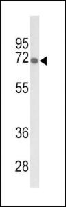 Anti-GBE1 Rabbit Polyclonal Antibody (APC (Allophycocyanin))