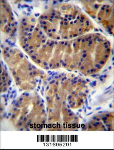 Anti-IL17B Rabbit Polyclonal Antibody (Biotin)